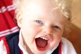 Angelman syndrome is a complex genetic condition that leads to developmental and neurological challenges